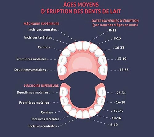 orthodontiste Guilherand Granges percee dentaire 1 